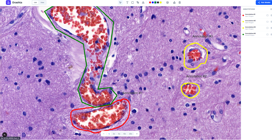 Pathology Workflow App (AIIMS Delhi) project screenshot